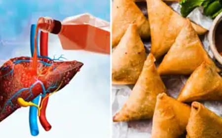 इन चीजों के सेवन करने से बचें, कम हो जाएगा लिवर से जुड़ी बीमारियों का खतरा 