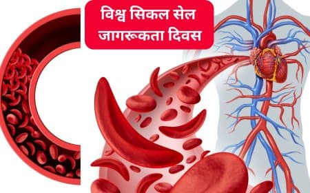 रक्त की बूँद में छिपा संघर्ष: विश्व सिकल सेल जागरूकता दिवस