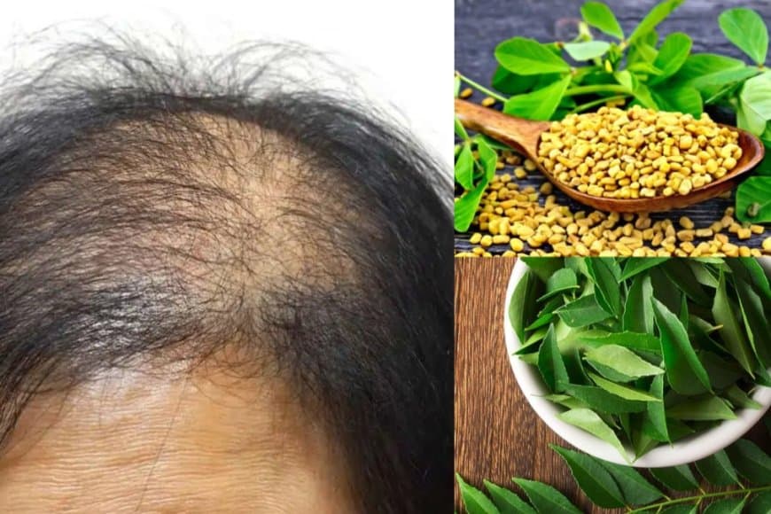 टूटते-झड़ते बालों से हो रही परेशानी तो करी पत्ते से बनाएं हेयर मास्क 