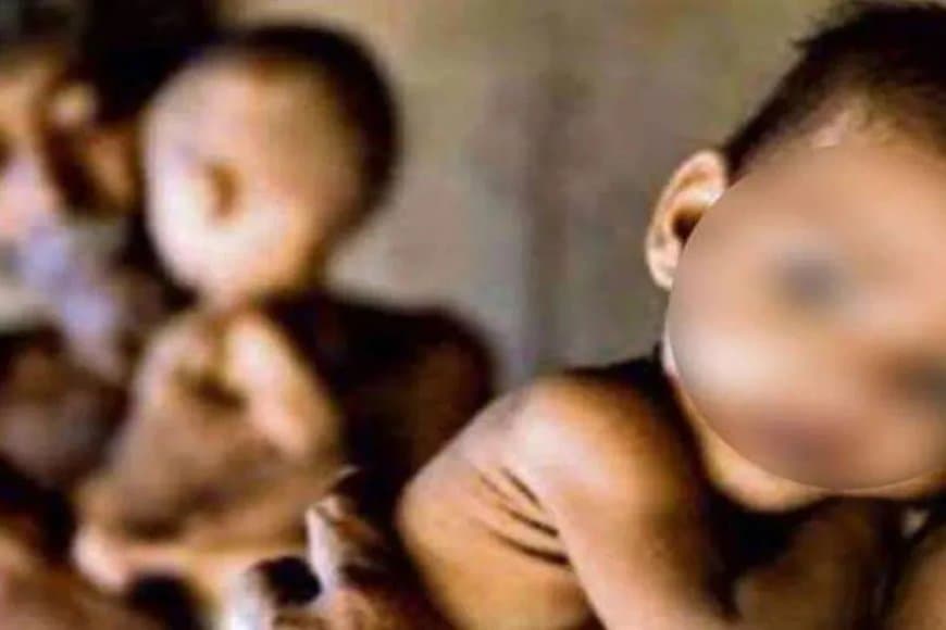 शर्मनाक! पोषण के लिए 4895 करोड़...फिर भी मध्यप्रदेश में कुपोषण 