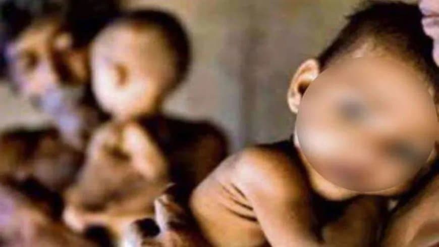 शर्मनाक! पोषण के लिए 4895 करोड़...फिर भी मध्यप्रदेश में कुपोषण 