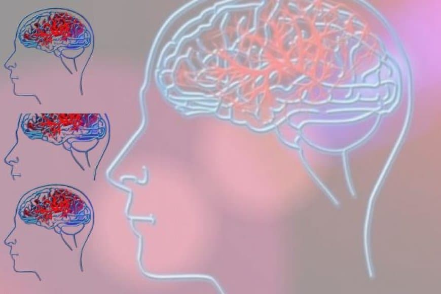विश्व मस्तिष्क दिवस: हमारे सबसे महत्वपूर्ण अंग का स्वास्थ्य