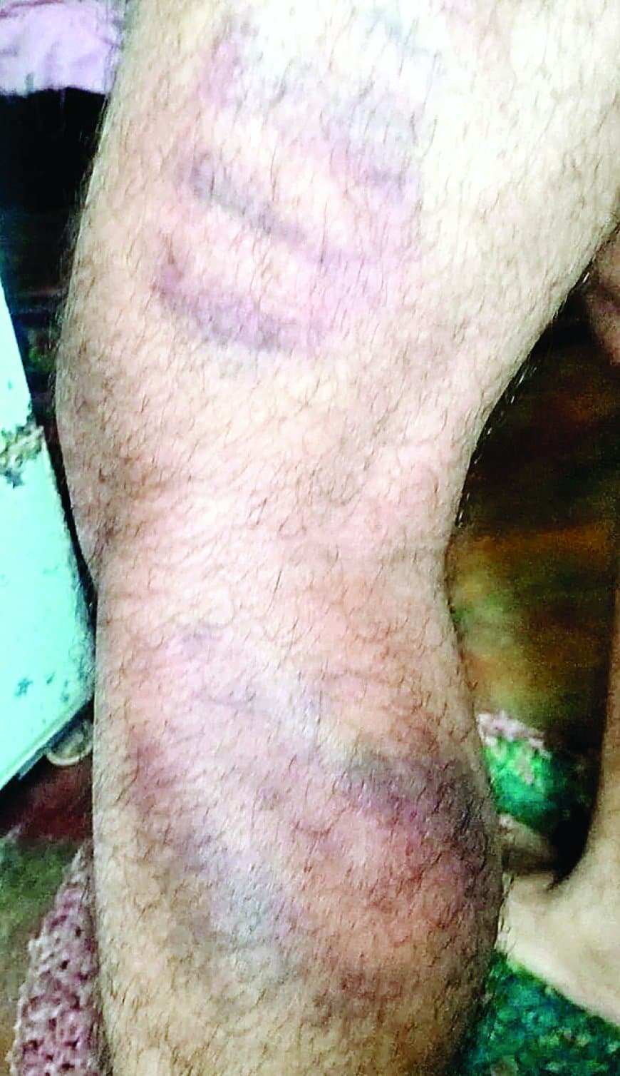 चुरहट थाने में फिर मानवता शर्मसार, रिश्वत की मांग