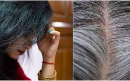 इस विटामिन की कमी से कम उम्र में बाल होने लगते सफेद, जानें इसके बारे में  