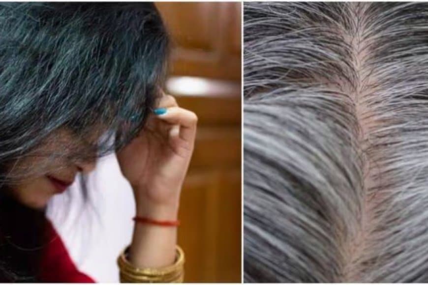 इस विटामिन की कमी से कम उम्र में बाल होने लगते सफेद, जानें इसके बारे में  