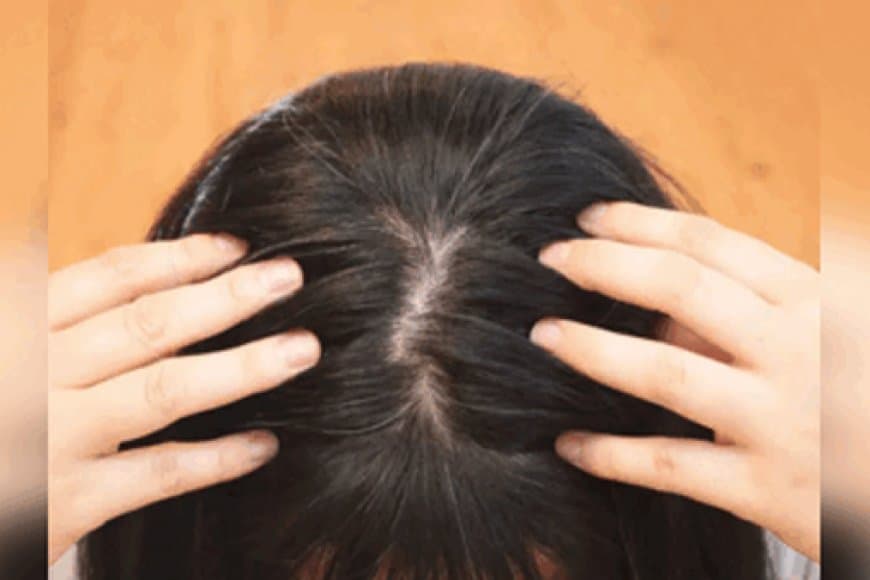 सफेद बालों को काला करने के सबसे असरदार तरीके, एक-एक  हो जाएगा काला 