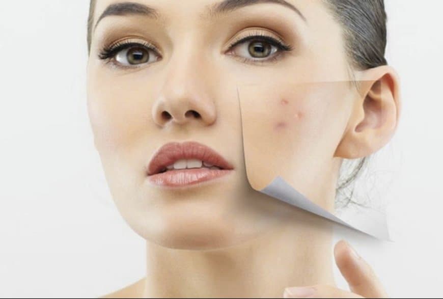 चेहरे पर दाग-धब्बों से छुटकारा पाने के लिए लगाएं इन 2 चीजों को मिक्स  
