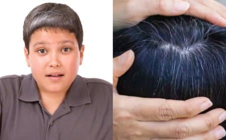 कम उम्र हो रहे सफेद बालों के पीछे कहीं ये वजहें तो नहीं, अगर ऐसा है तो तुरंत संभल जाएं ! 