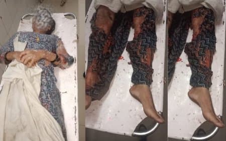 ग्वालियर... निकाह से इंकार पर भड़के जेठ ने भाई की पत्नी पर फेंका तेजाब