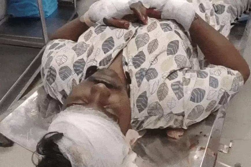 भोपाल: पुरानी रंजिश में युवक पर जानलेवा हमला, तलवार से किए कई वार; AIIMS में भर्ती