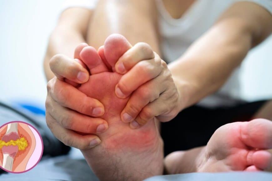 सर्दियों में अचानक तेजी से बढ़ने लगता है यूरिक एसिड? इन उपायों से कर सकते हैं बचाव 