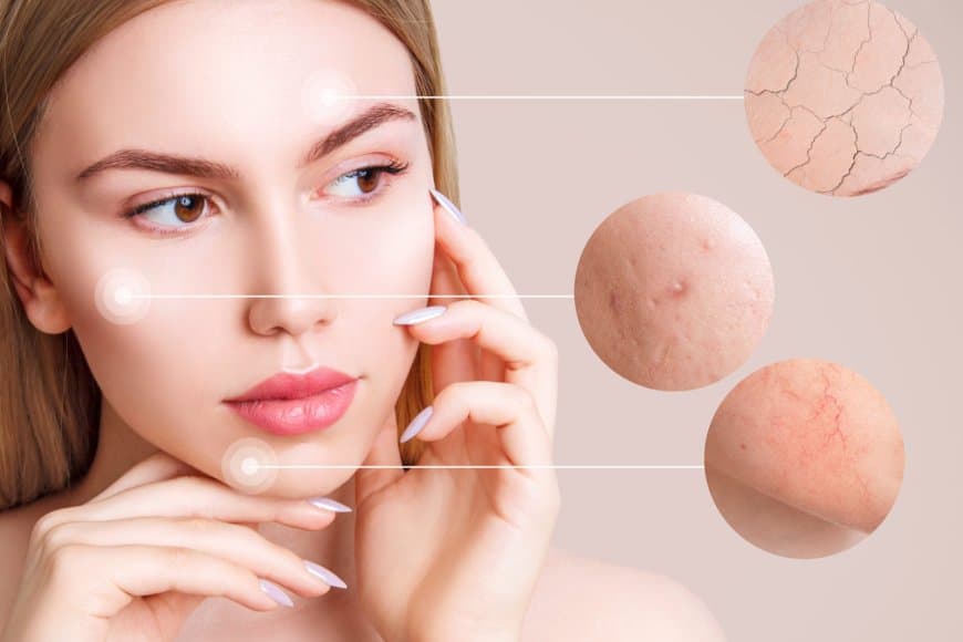 घर की रसोई में छिपा है ख़ूबसूरती का खजाना, जो झुर्रियों से लेकर त्वचा के रूखेपन को कर देगा गायब