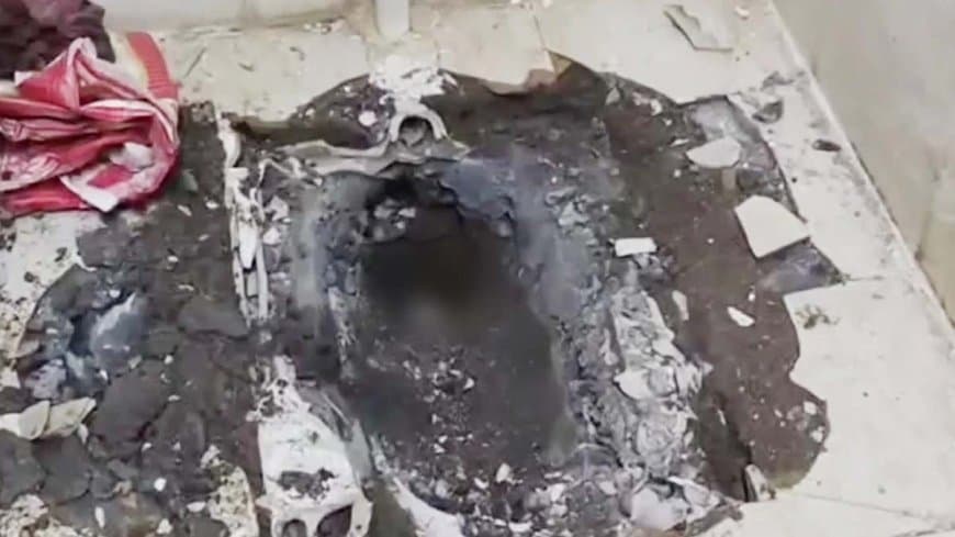 छिंदवाड़ा: परासिया सिविल अस्पताल के टॉयलेट कमोड में मिला नवजात का शव, 8 घंटे बाद निकाला गया