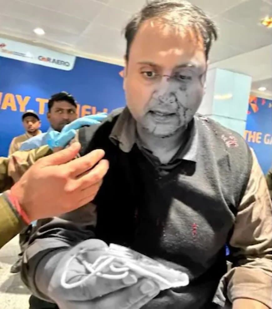 यात्री ने एअर इंडिया एक्सप्रेस के एक पायलट पर हमला करने का आरोप लगाया है।