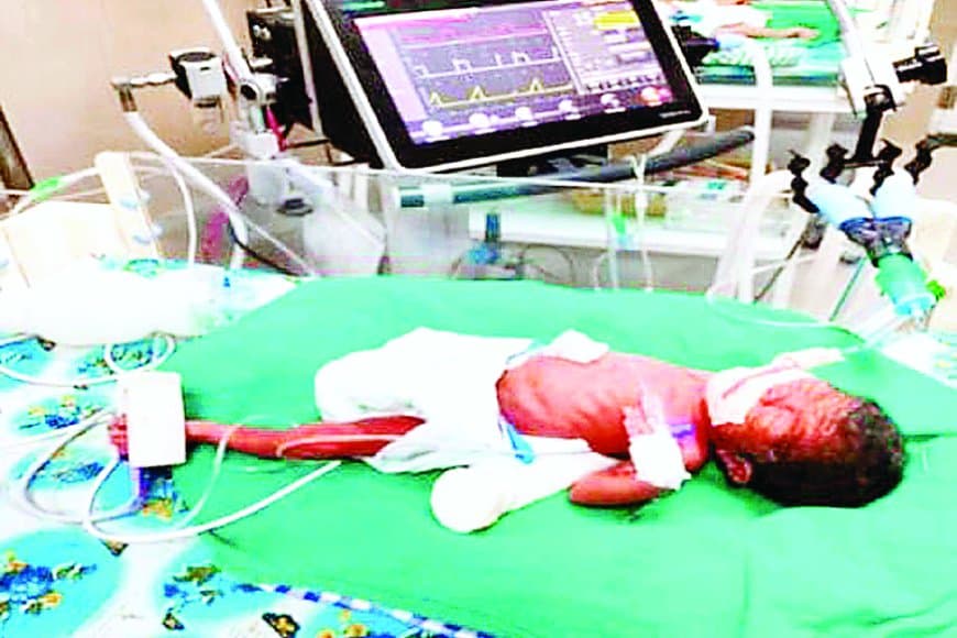 750 ग्राम का नवजात, 53 दिन की जंग, रीवा एसएनसीयू ने रचा जीवन का चमत्कार