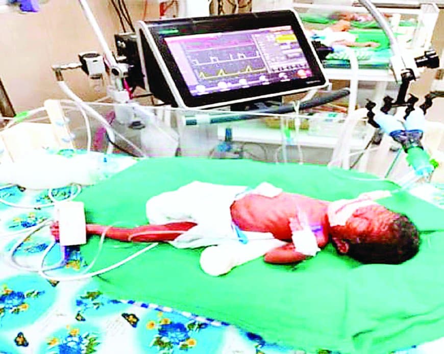 750 ग्राम का नवजात, 53 दिन की जंग, रीवा एसएनसीयू ने रचा जीवन का चमत्कार