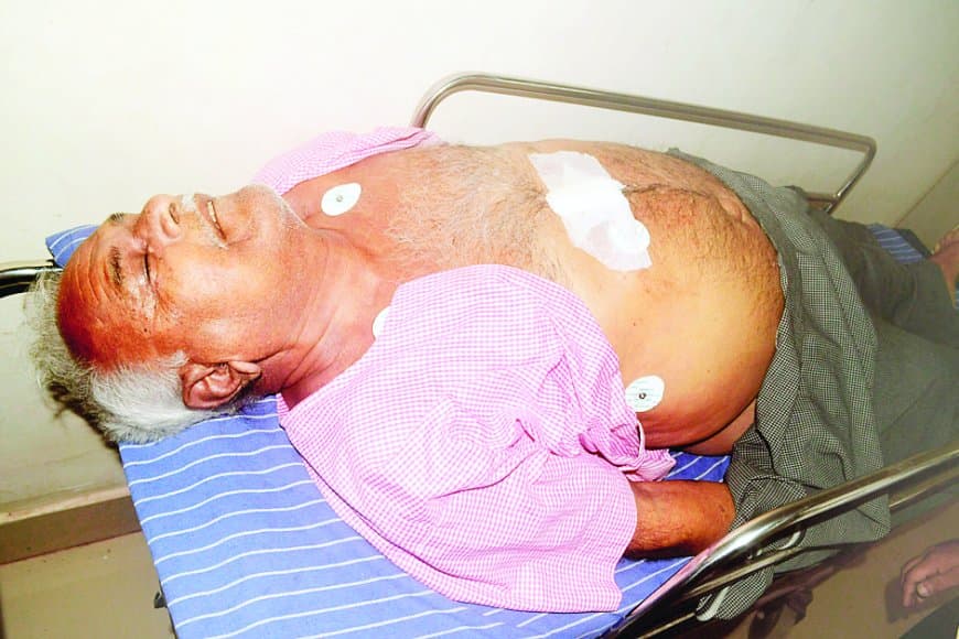 एंडोस्कोपी के दौरान लापरवाही से बुजुर्ग की मौत, निजी अस्पताल में परिजनों का हंगामा