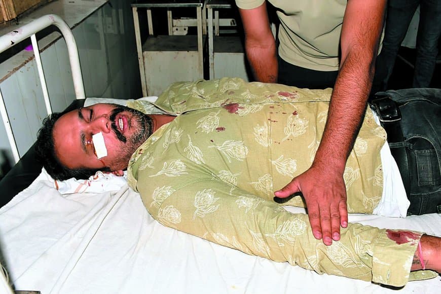 पेप्टेक सिटी में लेनदेन को लेकर चली गोली, घायल अस्पताल में भर्ती, आरोपियों की तलाश में जुटी पुलिस