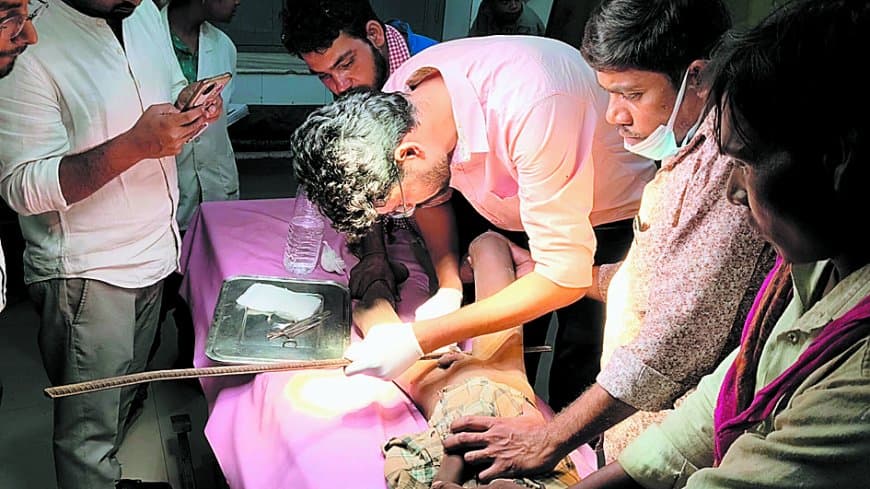 सरिया पर गिरा मासूम अमन, त्वरित ऑपरेशन से बची उसकी जान