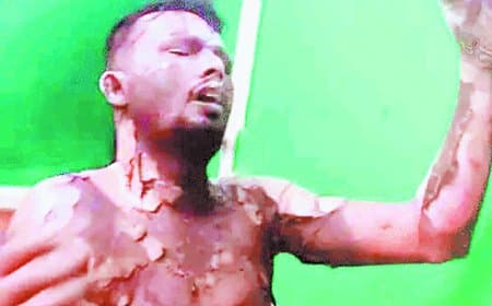 मऊगंज में चार युवकों पर पेट्रोल डालकर जिंदा जलाने का प्रयास, एक की हालत गंभीर, प्रधान आरक्षक निलंबित