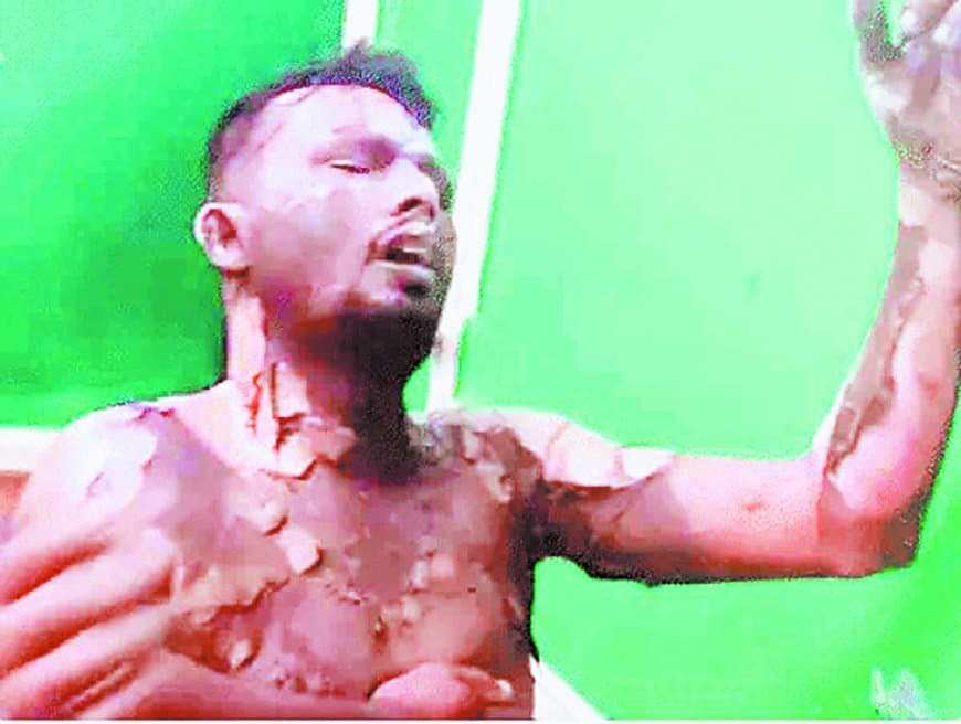मऊगंज में चार युवकों पर पेट्रोल डालकर जिंदा जलाने का प्रयास, एक की हालत गंभीर, प्रधान आरक्षक निलंबित