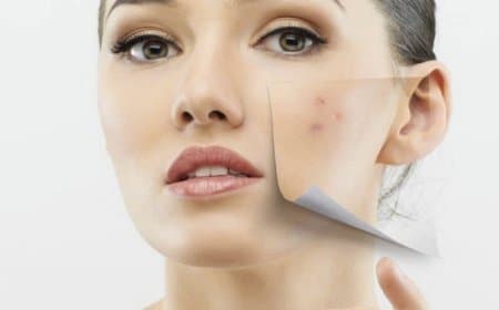 चेहरे पर दाग-धब्बों से छुटकारा पाने के लिए लगाएं इन 2 चीजों को मिक्स