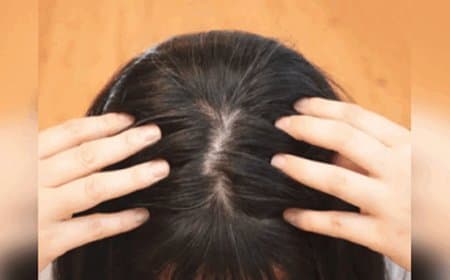 सफेद बालों को काला करने के सबसे असरदार तरीके, एक-एक  हो जाएगा काला