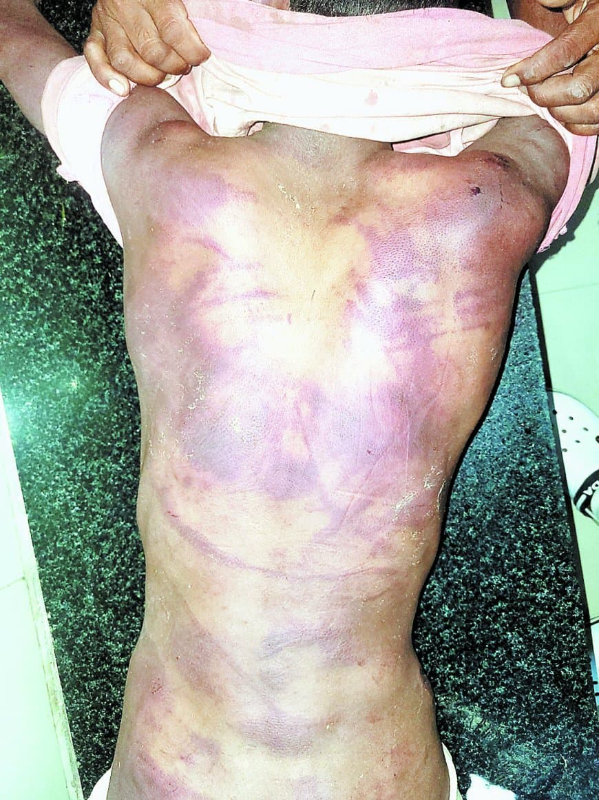 नाबालिग से संबंध मामले में युवक की पिटाई, दोनों पक्षों पर पुलिस ने कार्रवाई की नाबालिग से संबंध मामले में युवक की पिटाई, दोनों पक्षों पर पुलिस ने कार्रवाई की